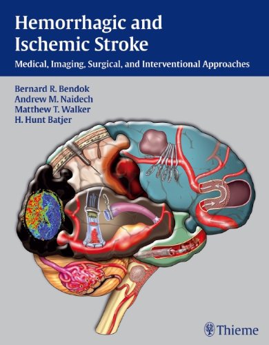 Hemorrhagic And Ischemic Stroke Medical Imaging Surgical And Interventional Approaches 1st Edition Bernard R Bendok