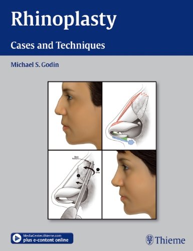 Rhinoplasty Cases And Techniques 1st Edition Michael S Godin