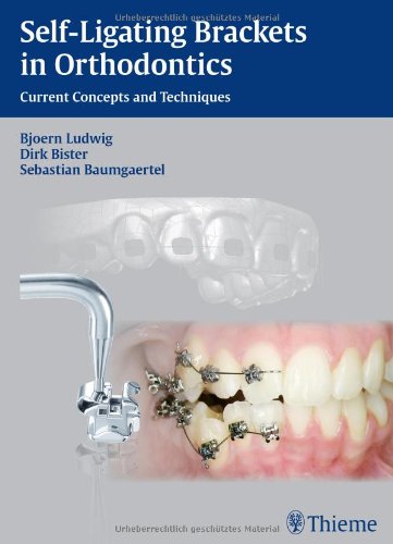 Selfligating Brackets In Orthodontics Current Concepts And Techniques 1st Edition Bjoern Ludwig