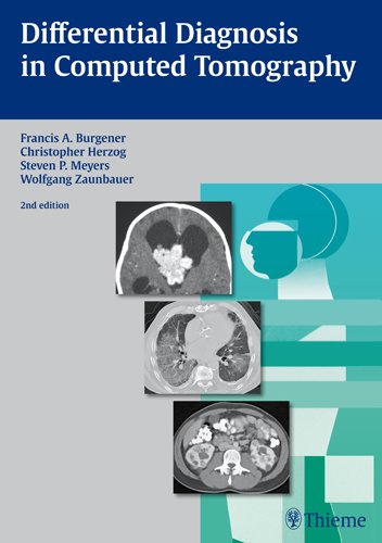 Differential Diagnosis In Computed Tomography 2nd Edition Francis A Burgener
