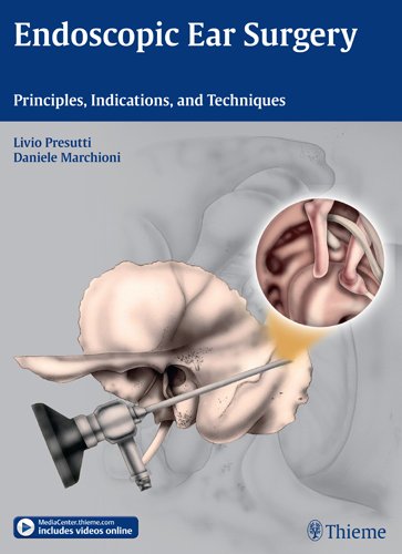 Endoscopic Ear Surgery Principles Indications And Techniques 1st Edition Livio Presutti