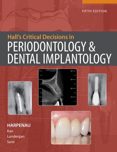 Halls Critical Decisions In Periodontology 5th Edition Lisa A Harpenau