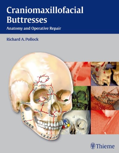 Craniomaxillofacial Buttresses Anatomy And Operative Repair 1st Edition Richard A Pollock