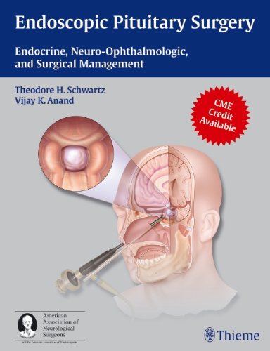 Endoscopic Pituitary Surgery Endocrine Neuroophthalmologic And Surgical Management 1st Edition Theodore H Schwartz