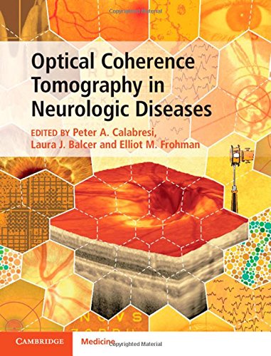 Optical Coherence Tomography In Neurologic Diseases 1st Edition Peter A Calabresi
