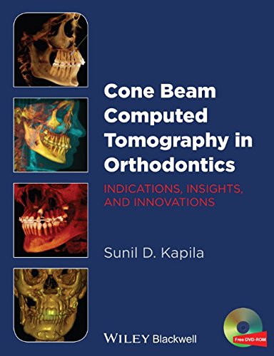 Cone Beam Computed Tomography In Orthodontics Indications Insights And Innovations 1st Edition Sunil Kapila