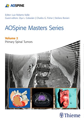 Aospine Masters Series Volume 2 Primary Spinal Tumors 1st Edition Luiz Roberto Gomes Vialle