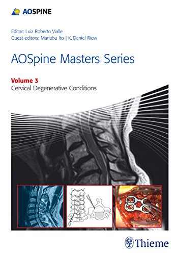 Aospine Masters Series Volume 3 Cervical Degenerative Conditions 1st Edition Luiz Roberto Gomes Vialle