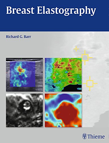 Breast Elastography 1st Edition Richard G Barr