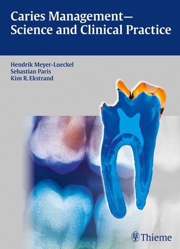 Caries Management Science And Clinical Practice 1st Edition Meyerlueckel
