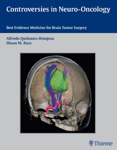 Controversies In Neurooncology Bestevidence Medicine For Brain Tumor Surgery 1st Edition Quioneshinojosa