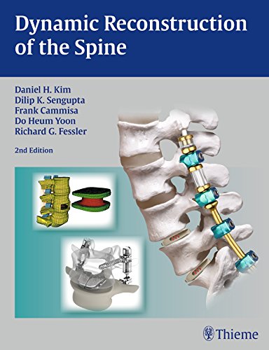 Dynamic Reconstruction Of The Spine 2nd Edition Cammisa Frank P Fessler
