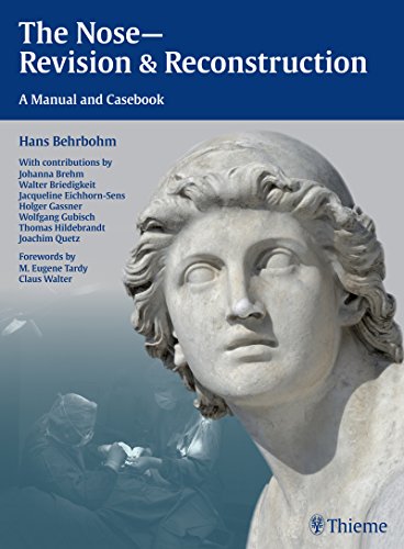The Nose Revision And Reconstruction A Manual And Casebook 1st Edition Behrbohm