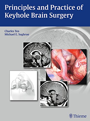 Principles And Practice Of Keyhole Brain Surgery 1st Edition Sughrue
