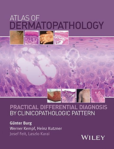 Atlas Of Dermatopathology Practical Differential Diagnosis By Clinicopathologic Pattern 1st Edition Burg