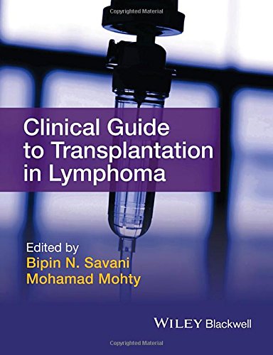 Clinical Guide To Transplantation In Lymphoma 1st Edition Mohty