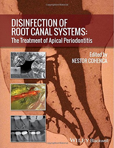 Disinfection Of Root Canal Systems The Treatment Of Apical Periodontitis 1st Edition Cohenca