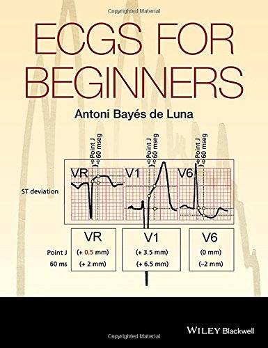 Ecgs For Beginners 1st Edition Bays De Luna Antoni
