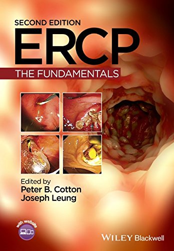 Ercp The Fundamentals 2nd Edition Peter B Cotton Joseph W Leung