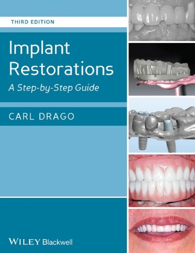 Implant Restorations A Step By Step Guide 3rd Edition Drago
