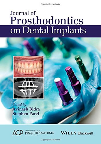 Journal Of Prosthodontics On Dental Implants 1st Edition Bidra