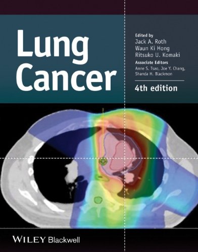 Lung Cancer 4th Edition Jack A Roth Waun Ki Hong Ritsuko U Komaki