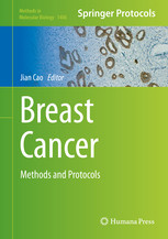 Breast Cancer Methods And Protocols Jian Cao