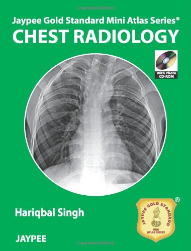 Chest Radiology 1st Edition Hariqbal Singh