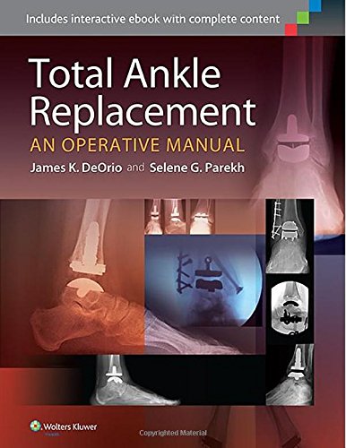 Total Ankle Replacement An Operative Manual 1 Harpsc James K Deorio