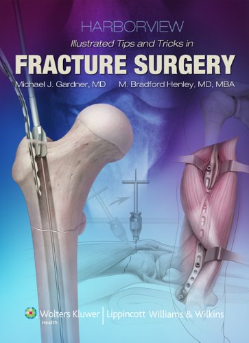 Harborview Illustrated Tips And Tricks In Fracture Surgery 1st Edition Michael J Gardner