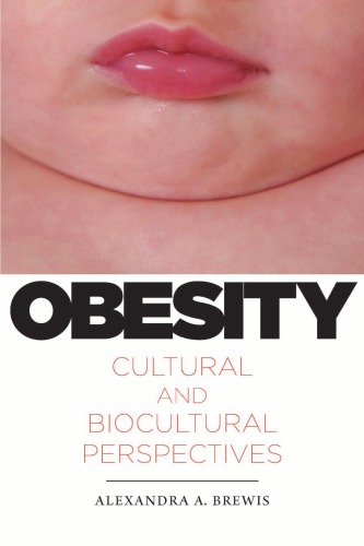 Obesity Cultural And Biocultural Perspectives Alexandra A Brewis