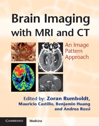 Brain Imaging With Mri And Ct An Image Pattern Approach 1st Edition Zoran Rumboldt Et Al Eds