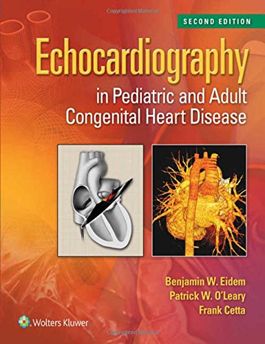Echocardiography In Pediatric And Adult Congenital Heart Disease 2nd Edition Benjamin W Eidem