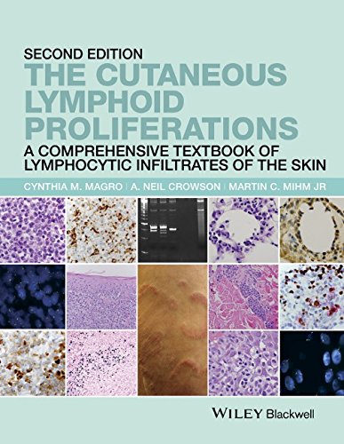 The Cutaneous Lymphoid Proliferations A Comprehensive Textbook Of Lymphocytic Infiltrates Of The Skin 2nd Edition Cynthia M Magro