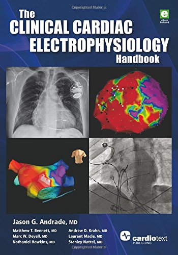 The Clinical Cardiac Electrophysiology Handbook 1st Edition Jason G Andrade Et Al