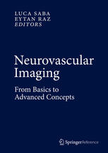 Neurovascular Imaging From Basics To Advanced Concepts 1st Edition Luca Saba