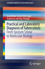 Practical And Laboratory Diagnosis Of Tuberculosis From Sputum Smear To Molecular Biology 1st Edition Guadalupe Garcaelorriaga