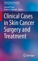 Clinical Cases In Skin Cancer Surgery And Treatment 1st Edition Sharad P Paul