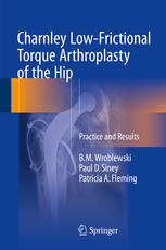 Charnley Lowfrictional Torque Arthroplasty Of The Hip Practice And Results 1st Edition Bm Wroblewski