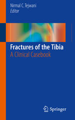 Fractures Of The Tibia A Clinical Casebook 1st Edition Nirmal C Tejwani Eds