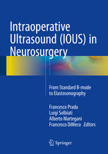 Intraoperative Ultrasound Ious In Neurosurgery From Standard Bmode To Elastosonography 1st Edition Francesco Prada