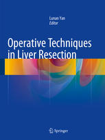 Operative Techniques In Liver Resection 1st Edition Lunan Yan Eds