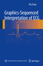 Graphicssequenced Interpretation Of Ecg 1st Edition Rui Zeng Eds