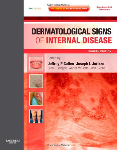 Dermatological Signs Of Internal Disease 4th Edition Jeffrey P Callen