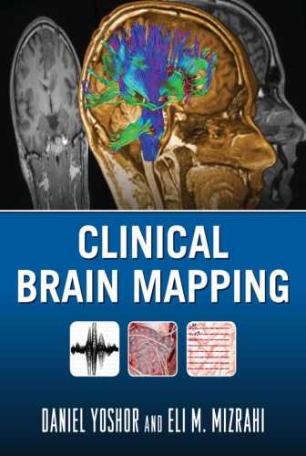 Clinical Brain Mapping 1st Daniel Yoshor Eli Mizrahi