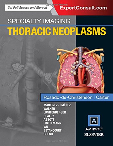 Specialty Imaging Thoracic Neoplasms 1st Edition Melissa L Rosadodechristenson Et Al