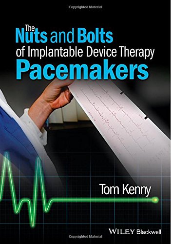 The Nuts And Bolts Of Implantable Device Therapy Pacemakers 1st Edition Kenny
