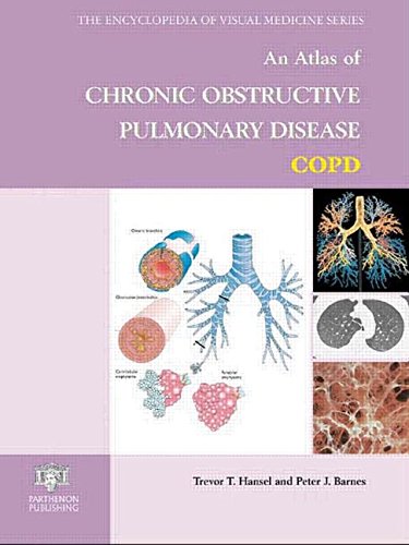 An Atlas Of Chronic Obstructive Pulmonary Disease Copd 1st Edition Hansel