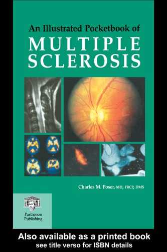 An Illustrated Pocketbook Of Multiple Sclerosis Poser Charles M