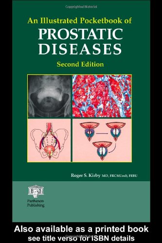 An Illustrated Pocketbook Of Prostatic Diseases 2nd Ed Kirby